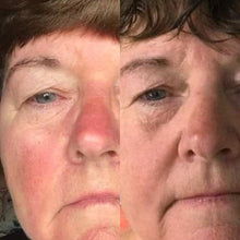 Load image into Gallery viewer, Dragons Blood Sensitive Night Rest Moisturiser